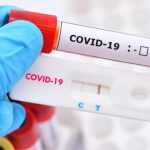 COVID-19 PCR Test Requirements to Travel to Ethiopia